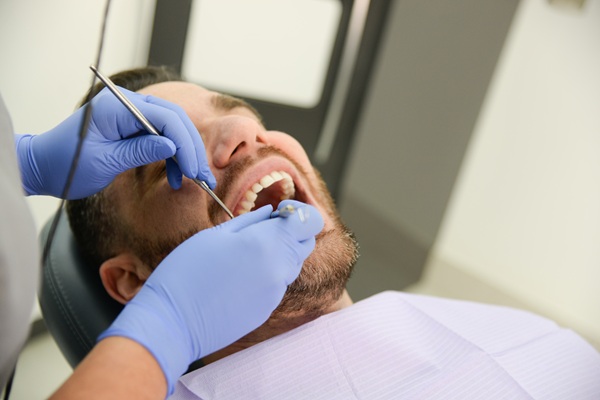 FAQs About Root Canal Treatment